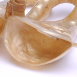 image of ear trumpet
